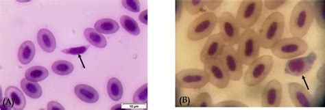  Leucocytozoon! Un Parasite Microscopique Qui Se Délecte des Globules Blancs de Ses Hôtes