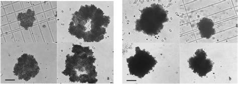  Ochromonas: Un Mystérieux Flagellé Qui Vit dans un Monde Invisible!