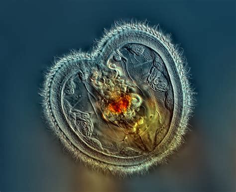 Vermamoeba: Une Créature Microscopique aux Époustouflants Mouvements de Glissement!